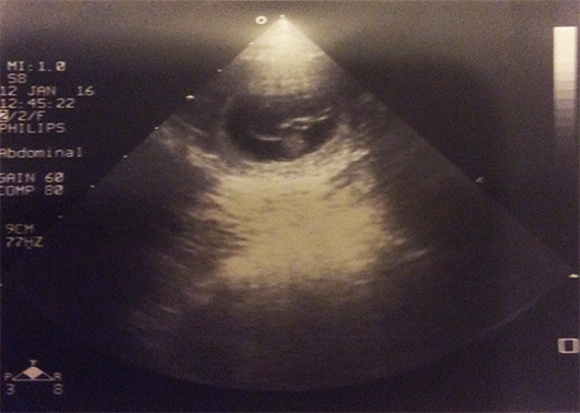ultrazvuk - gravidita argentinské dogy